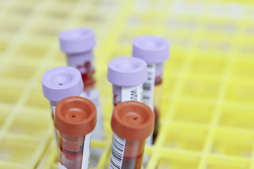 Laboratory preparation