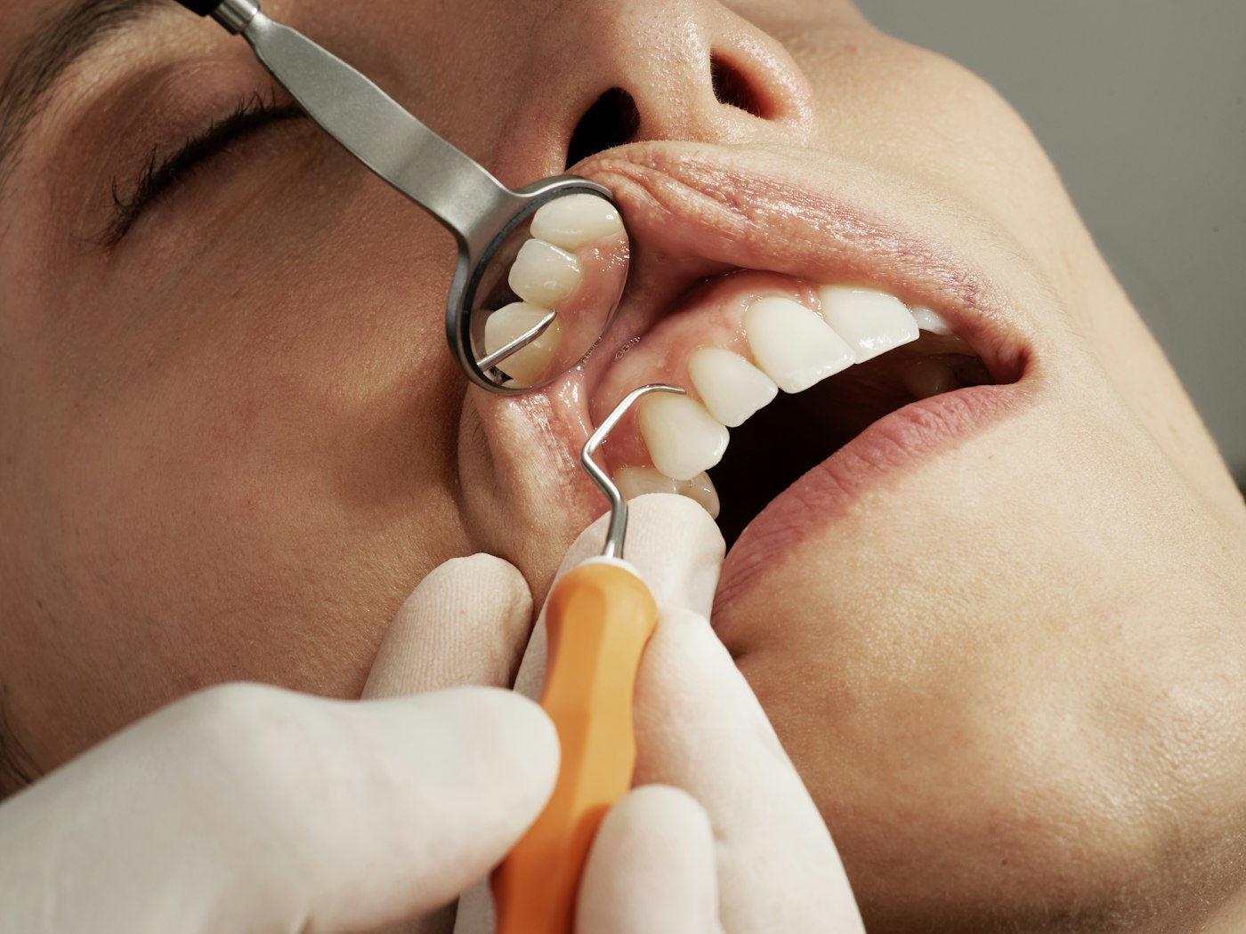 Dental examination with mirror and probe